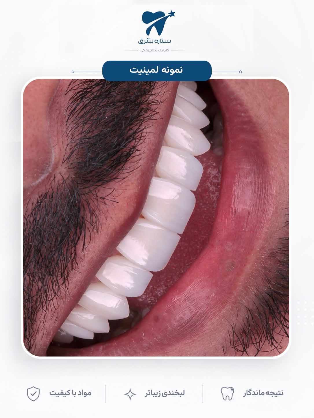 نمونه کار ارتودنسی ستاره شرق ۲
