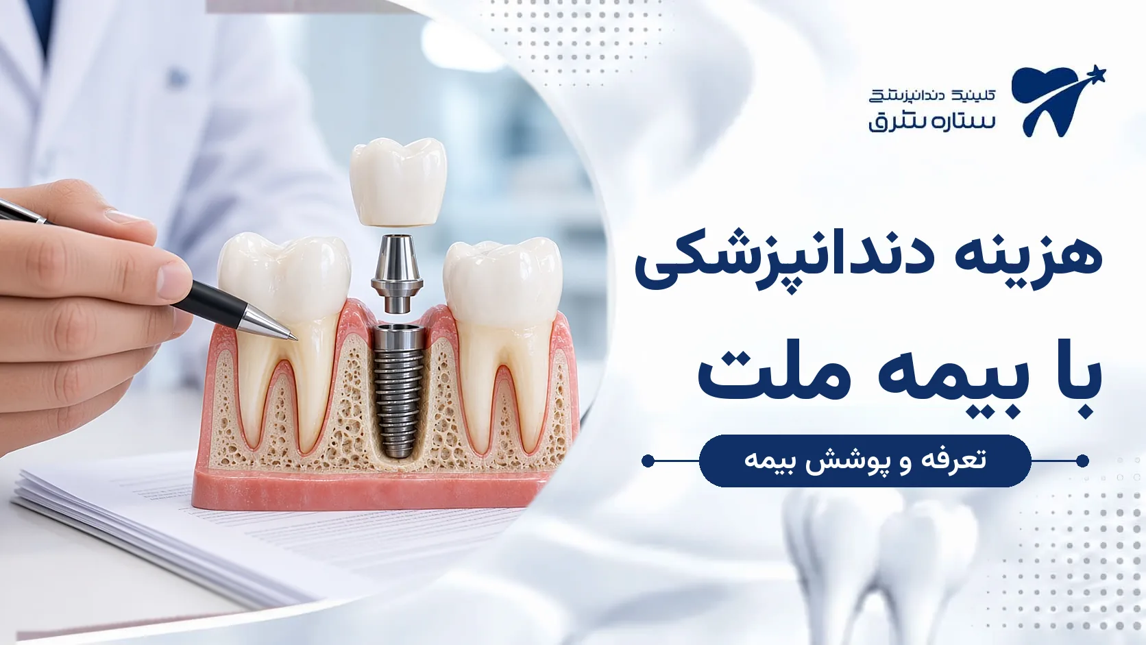 هزینه دندانپزشکی با بیمه ملت؛ سهم بیمه و هزینه‌ای که باید پرداخت کنید