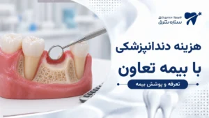 مدل فک و دندان، آینه دندانپزشکی و ماشین‌حساب برای بررسی هزینه