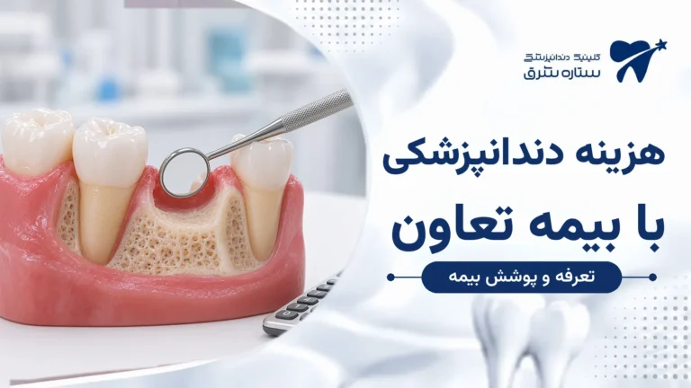 هزینه دندانپزشکی با بیمه تعاون؛ تعرفه، پوشش بیمه و سهم بیمار