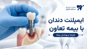 دست با دستکش آبی ایمپلنت تیتانیومی و روکش را روی مدل فک نگه داشته است