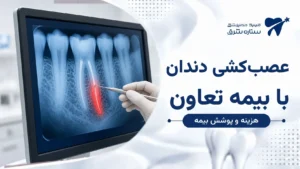 رادیوگرافی دندان با ریشه عصب‌کشی‌شده روی مانیتور کلینیک
